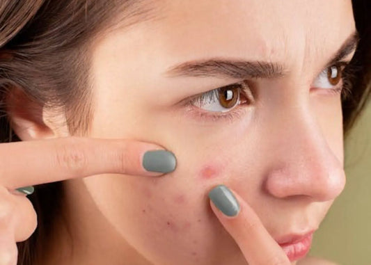 signs of skin aging and damage