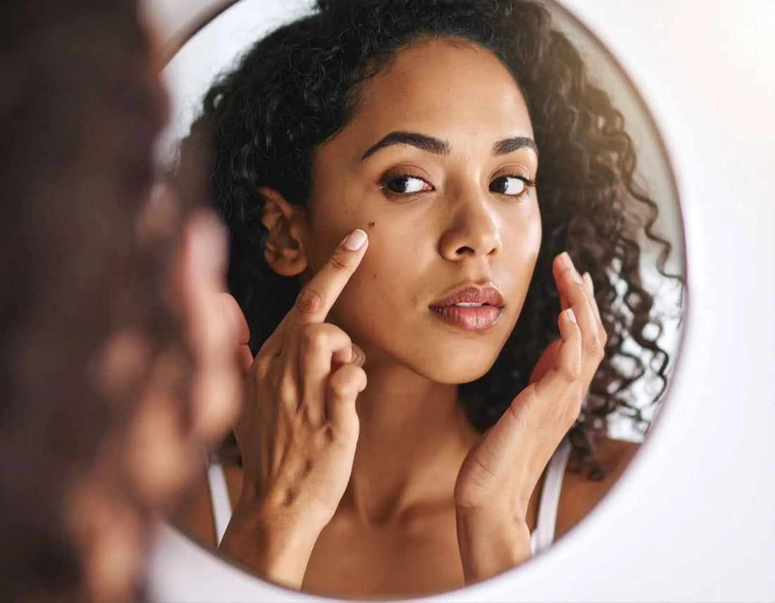 what is blemish prone skin​ and supplements for blemish free skin​